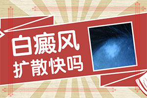 臉上出現白色斑塊是什么情況“斑形成的原因有哪些”什么原因會誘發