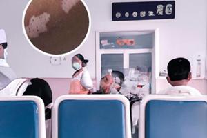 白癜風照308又復發(fā)了怎么回事