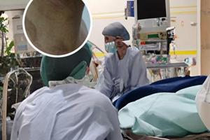 成人身上有白斑怎么引起的