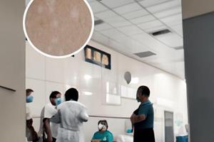 皮膚鏡網狀色沉