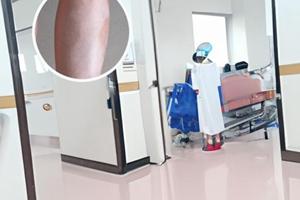 小孩臉上有白斑是缺鋅嗎怎么補(bǔ)呢