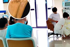 白點癲風用中藥治療好嗎