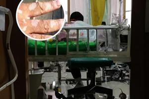 鹵米松乳膏成分有哪些