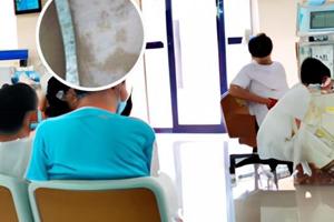 白殿病多長時間會擴散