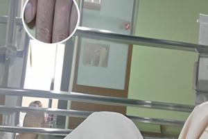 色素減退斑有什么前期癥狀表現(xiàn)怎么治療